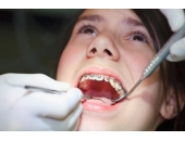 Chăm sóc về răng ra sao ?